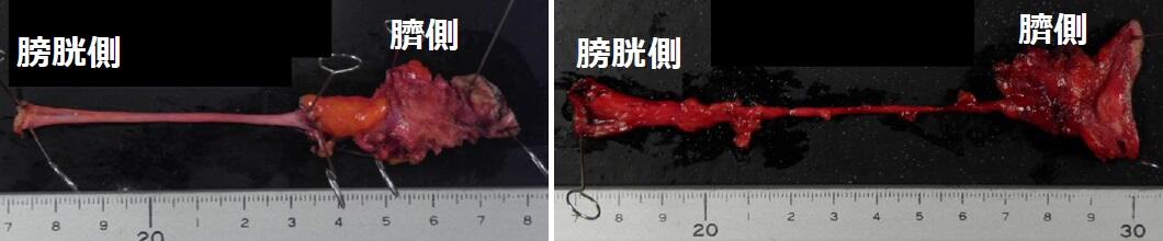 図5 摘出標本