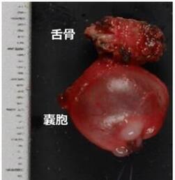 20250128_摘出標本