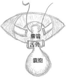 20250128_舌骨裏面