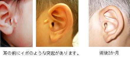 小児外科 診療部門のご案内 地方独立行政法人 市立吹田市民病院